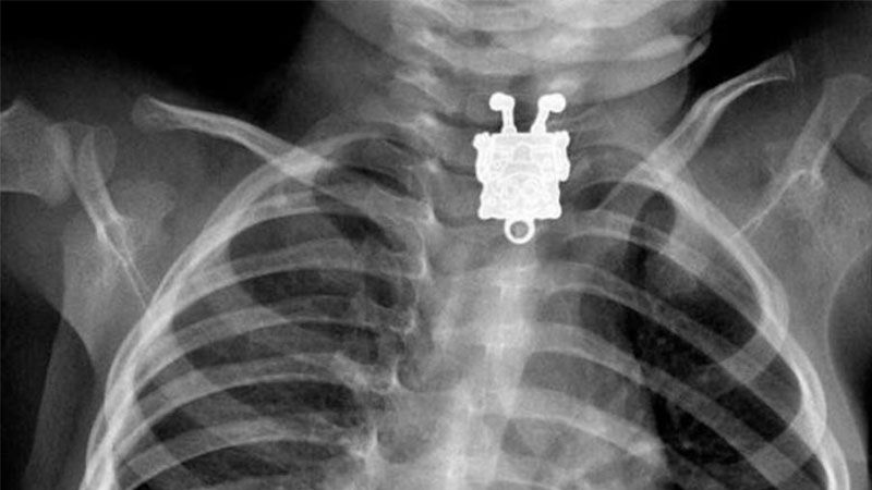 10 İlginç Röntgen Fotoğrafı